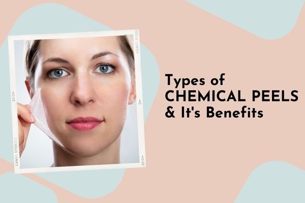 Chemical peels benefits