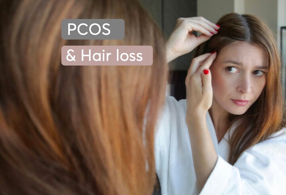 PCOS and hair loss