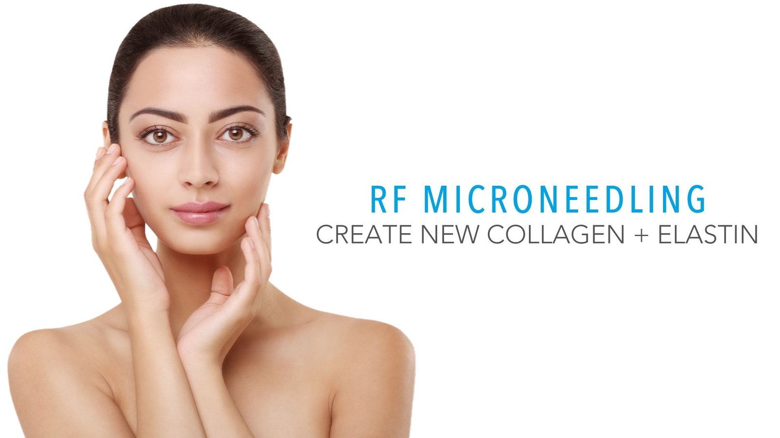 Microneedling treatment for Acne scars