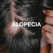 Alopecia